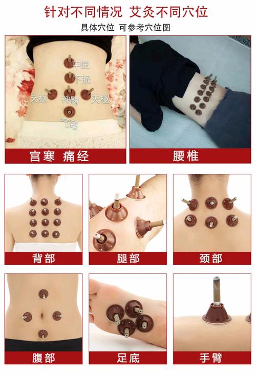 艾艾灸爱艾贴艾灸贴正品60粒深圳同仁堂蕲艾条李时珍三年陈艾条_7折