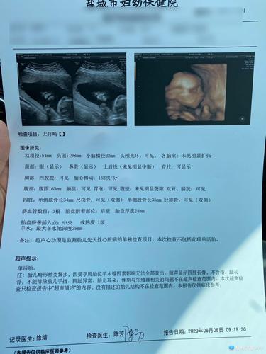 [试管婴儿]孕22周,今天早上四维秒过啦啦