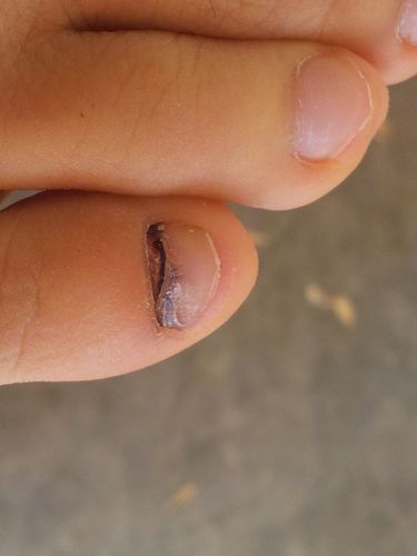 我快要去做伤残坚定了,请大神好心人告诉我,我这款有鉴定上10级吗?