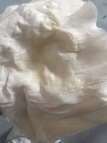 这个精子颜色正常吗 在手上是白的