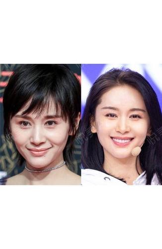 来看看什么是好看的苹果肌