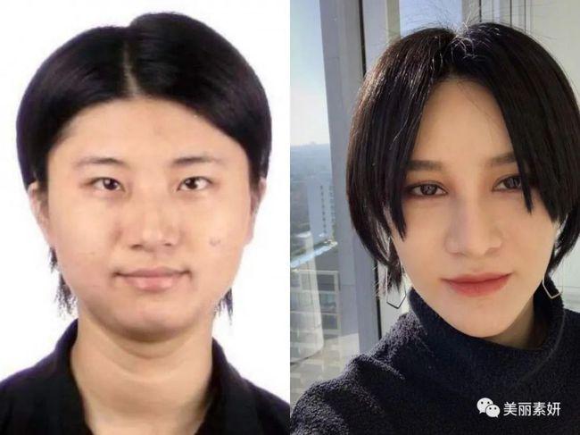 尚雯婕许飞上演塑料姐妹情2021扒一扒尚雯婕的整容史