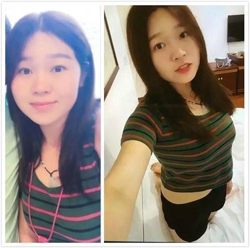 80斤女孩减肥长期不吃主食住进icu瘦真的是美的唯一标准