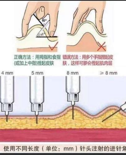 临渭区中医医院外科——第 六十四期业务学习(皮下