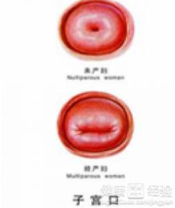 概 述 当前,白领女性更加容易遭到更年期综合征这个疾病的袭击.