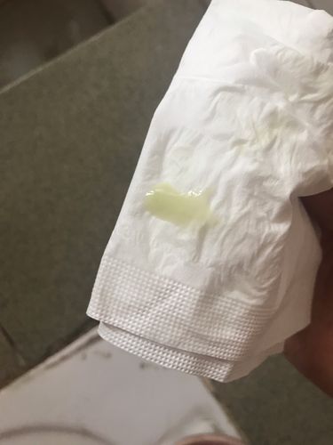 7周多了,上厕所偶尔有点白带呈绿色是不是有什么问题?