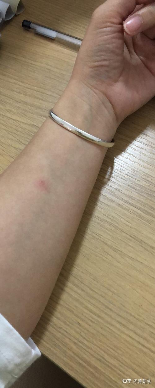 抗击结核小记录