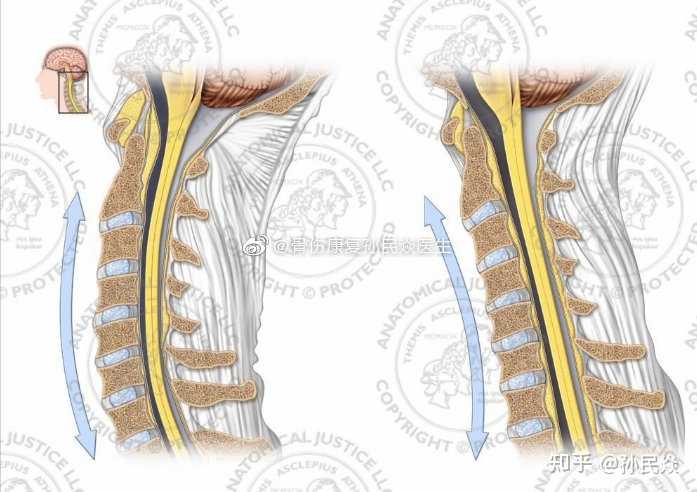 正常颈椎与反弓颈椎的形态区别