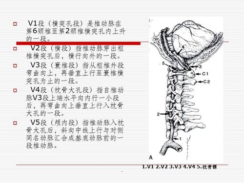 椎动脉分段ppt课件