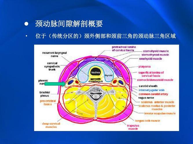 位于(传统分区的)颈外侧部和颈前三角的颈动脉三角区域