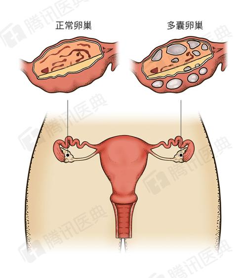 女生长得胖,竟然会"吓走"大姨妈?现在不减肥,以后怀不