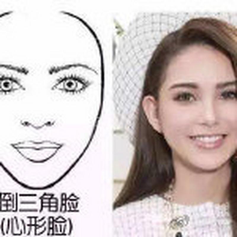 猴腮脸型,就是倒三角脸型,苹果肌萎缩,下巴尖小,腮帮子小或者没有