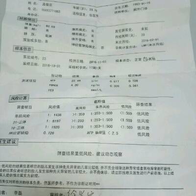 唐氏筛查报告单怎么看