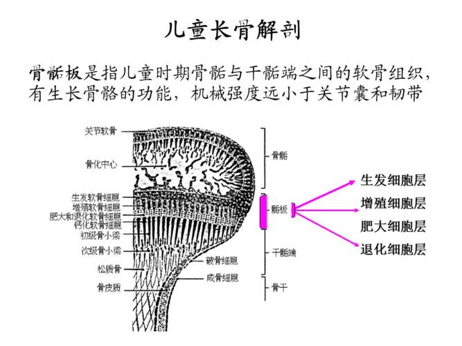 儿童骨骺损伤影像诊断