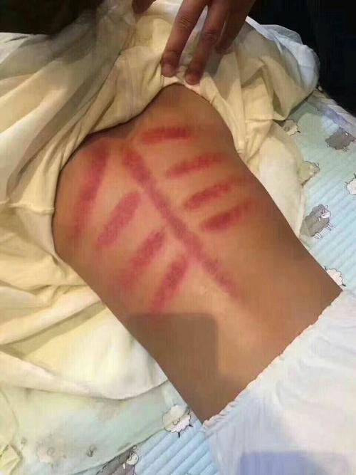 小儿推拿工作室