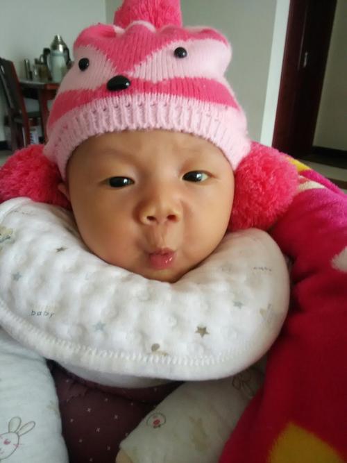 宝宝眼睛有血丝