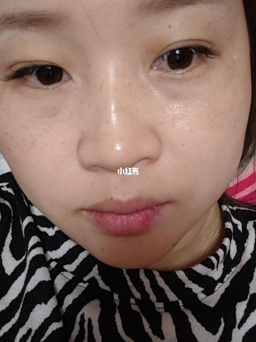 药水点斑第一天_nowall怎么样_美妆_医美整形