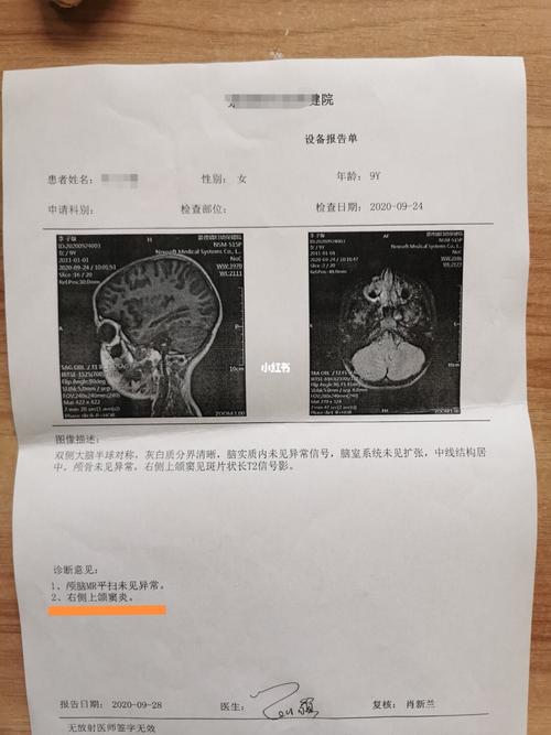 女儿右侧上颌窦炎_母婴_育儿_母婴_育儿经验