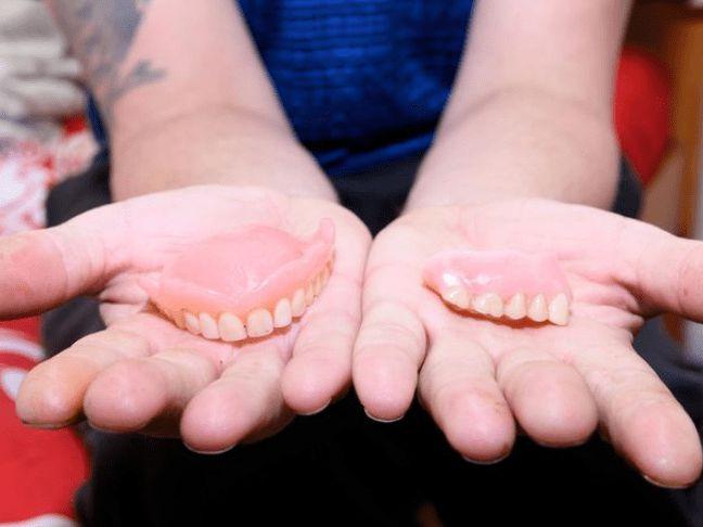 英53岁男子受新冠影响被20家诊所拒绝治疗,被迫戴死者捐赠的假牙