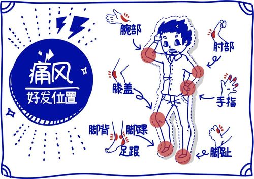 痛风部位有哪些?肢体末梢关节需注意