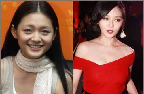 娱乐圈的女明星们,往往为了留住美丽容颜,整容便成了娱乐圈不公开的