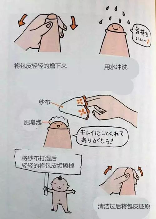 ❖术前:注意局部清洁,避免局部皮肤感染和泌尿道感染等,可适量