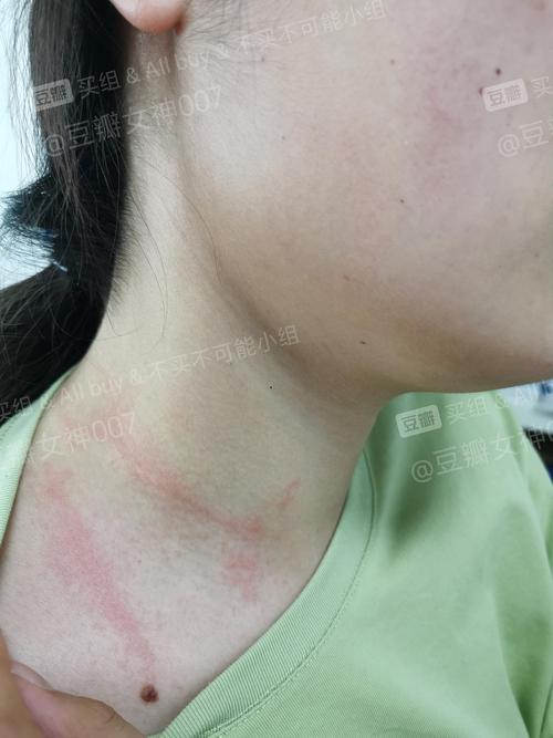 【反馈】避雷1688项链(过敏图慎入)