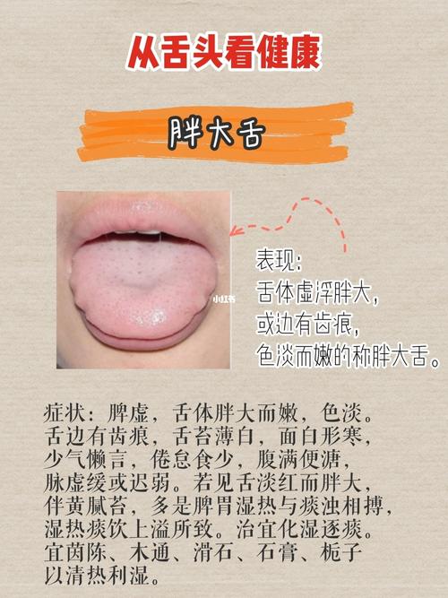 小舌头反应大问题 你的舌头处于哪种状态?_舌苔_脾虚