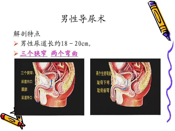 男性导尿术 解剖特点   男性尿道长约18-20cm.   三个狭窄 两个弯曲