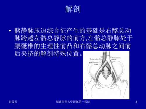 医学影像学-髂静脉压迫综合征.pdf 115页