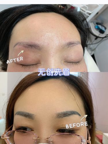超黑眉毛无创洗眉之后_洗眉_眉毛_纹眉_美妆_医美整形