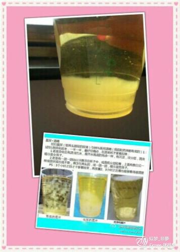 怀孕后酒精和尿怎么测男女,多久可以用酒精测男女