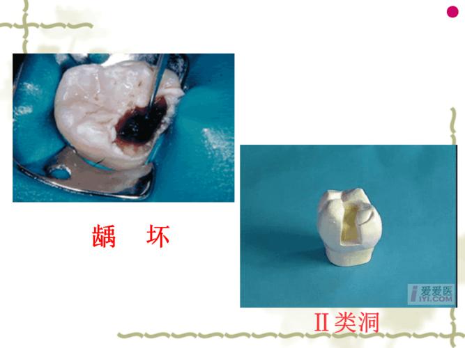 二类洞的制备ppt课件
