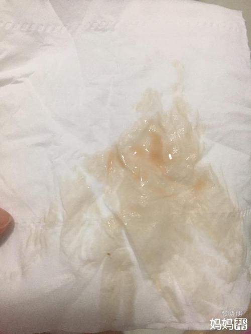 孕早期分泌物颜色