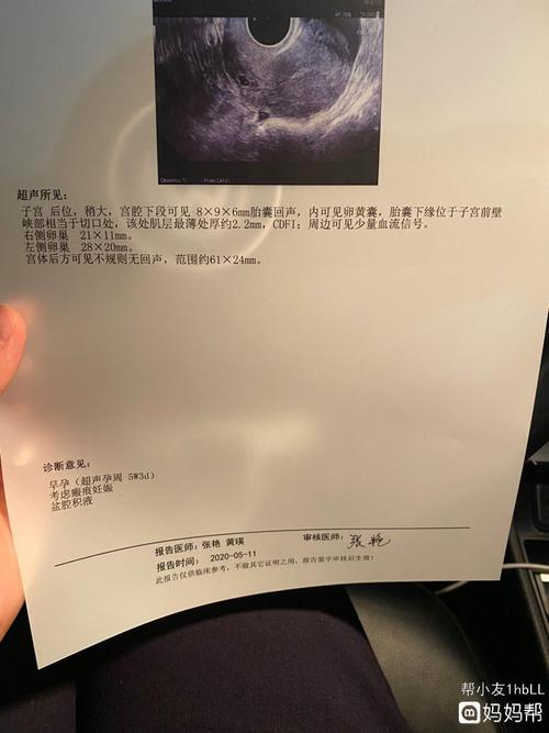 孕38天,检查为疤痕妊娠,请问可以要吗