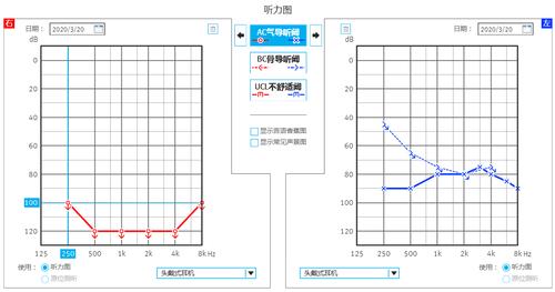 纯音测听的重要性--健耳听力助听器东塘店