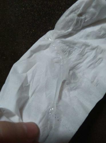 26号有这样的白带,今天又有这样的白带