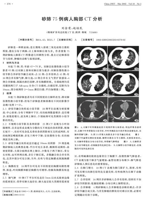 矽肺75例病人胸部ct分析.pdf