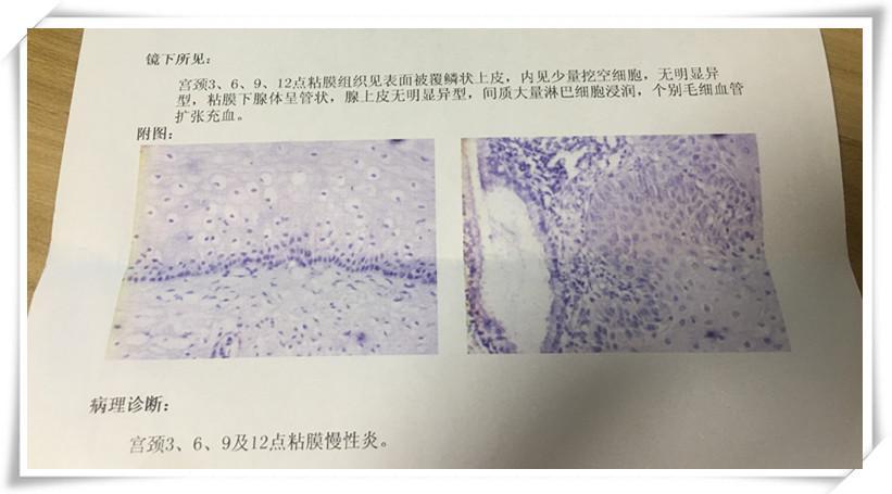 喜大普奔 | 支付宝&微信买药将能用社保卡结算!