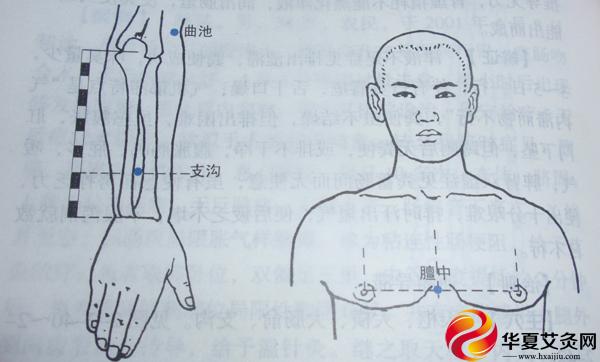 心绞痛的艾灸疗法 还你一个健康心脏