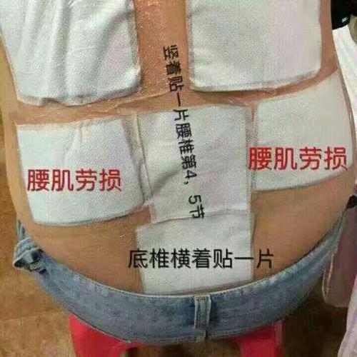 老猊膏药贴敷方法及注意事项