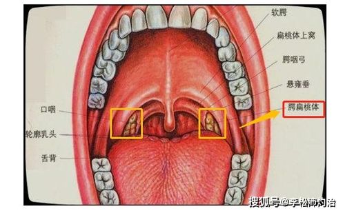 小孩扁桃体肿大二度以及3度随着年龄增长会自愈吗?