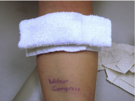 国际罕见病日:水源性荨麻疹,人居然会对水过敏?