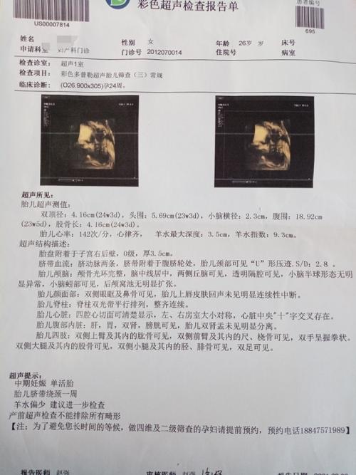孕24周四维彩超图片会看男孩儿女孩儿的