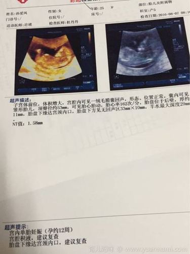 怀男孩的nt 已生男宝nt值参考