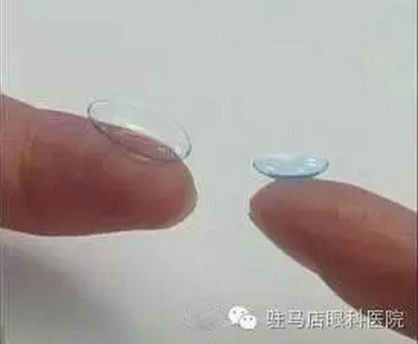 角膜塑形镜的知识