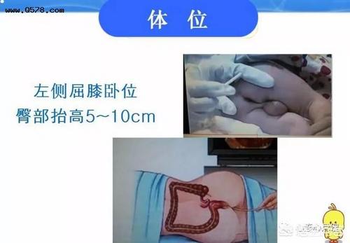 给宝宝灌肠副作用大么?