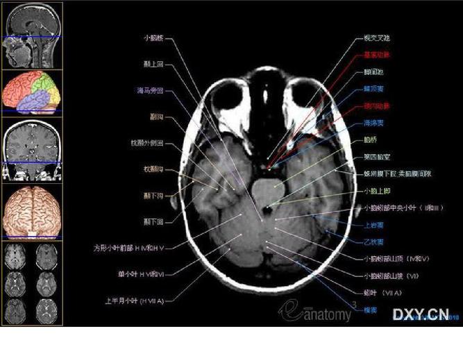 颅脑正常解剖 80页 免费 mri解剖—颅脑 420页 免费 颅脑 断面解剖-好