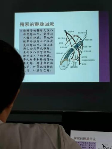 精索静脉曲张诊断治疗!