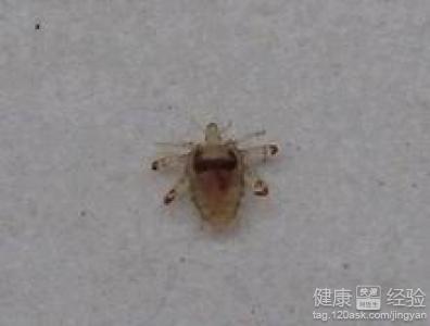 阴虱病怎么治疗